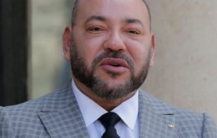 Morocco’s King undergoes successful heart surgery