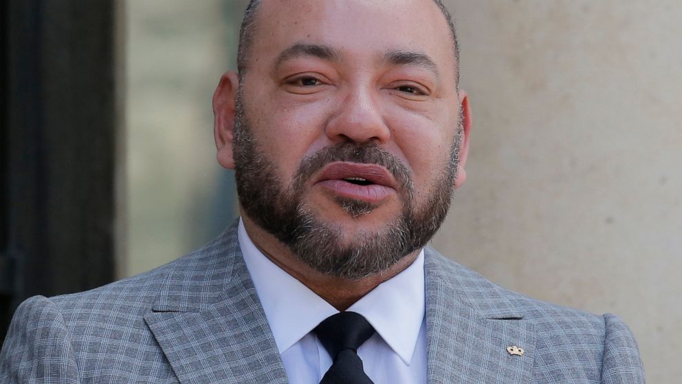 Morocco’s King undergoes successful heart surgery